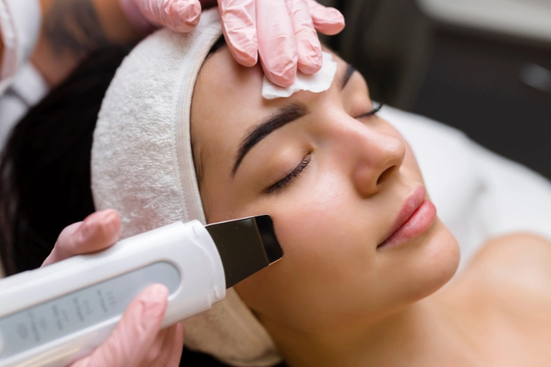 Peeling Ultrasónico y enzimas en Boadilla del Monte