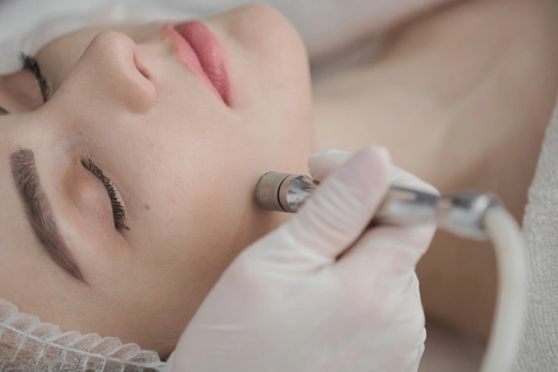 Peeling Diamond en Boadilla del Monte